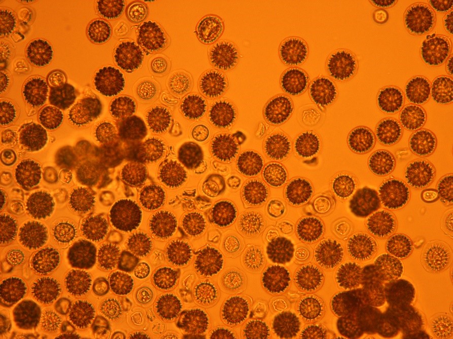 Microscope image of fungal teliospores